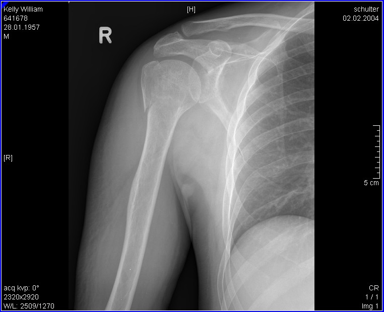 pre-operation
